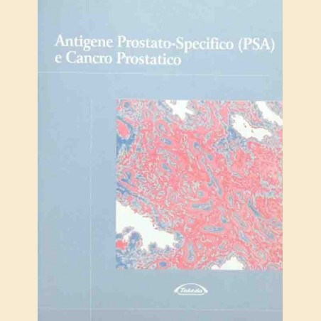 Antigene prostatico-specifico (PSA) e cancro prostatico