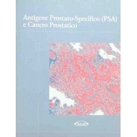 Antigene prostatico-specifico (PSA) e cancro prostatico